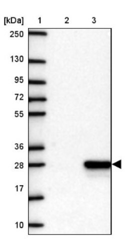 CRYGN Antibody, Novus Biologicals 0.1mL; Unlabeled:Antibodies, Polyclonal
